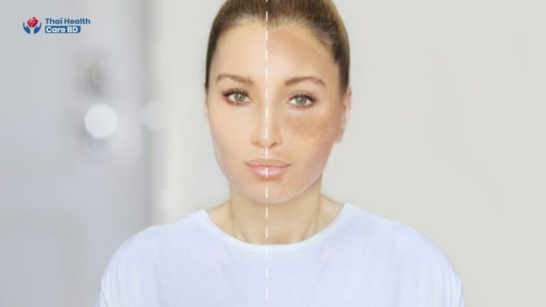 Skin Whitening Treatment in Bangkok, Thailand